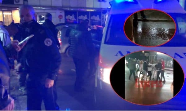 Lajmi i Fundit: Rrahje në grup në Kosovë, mes tyre përfshihet edhe një vajzë (FOTO)