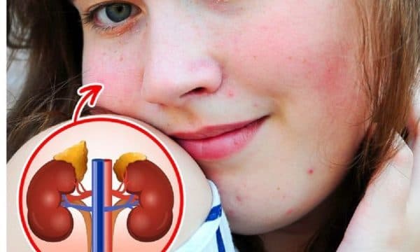Çfarë i ndodh trupit kur skuqemi në fytyrë?