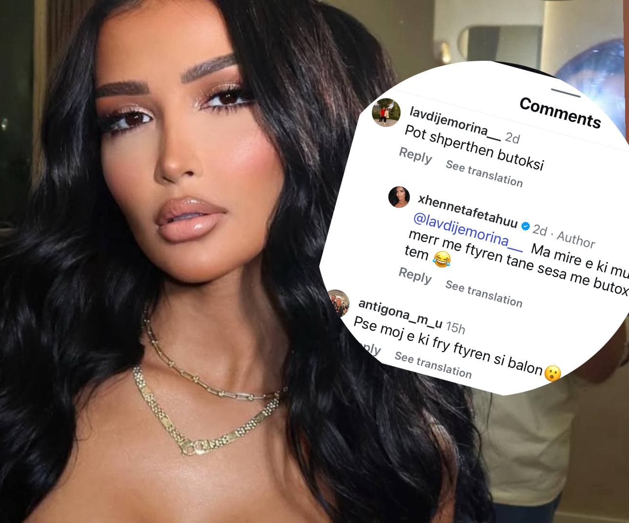 “Ruju po të shpërthen botoxi”, Xheneta replikon me ndjekësit e saj në Instagram (Foto)