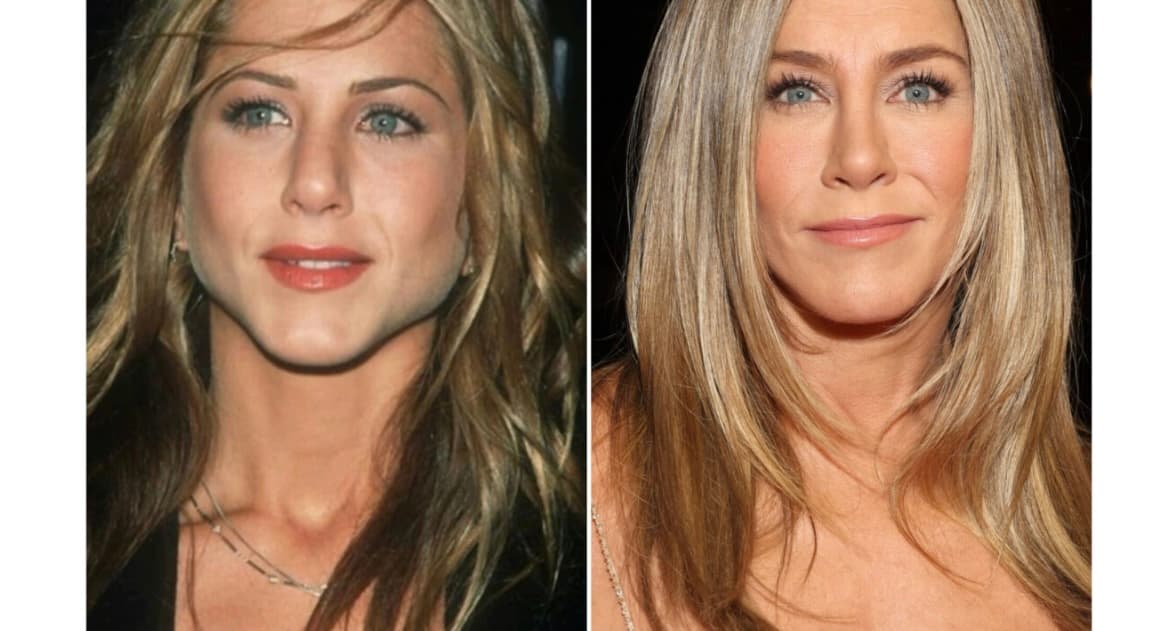 56 apo 36? Jennifer Aniston zbulon sekretet e pamjes rinore
