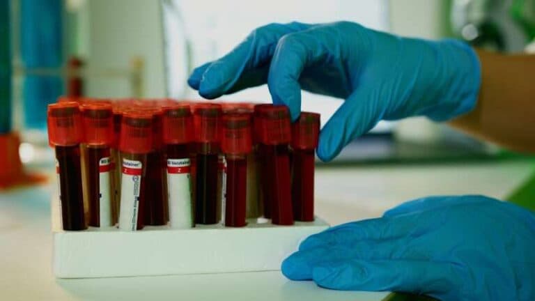 Test i ri gjaku zbulon moshën biologjike dhe rrezikun e sëmundjeve të lidhura me plakjen