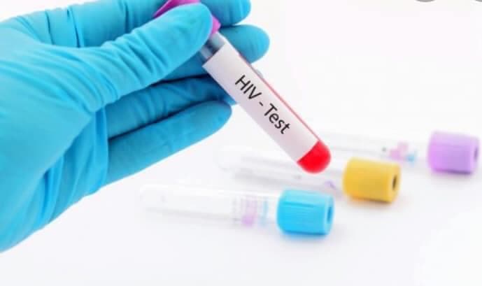 Në rritje numri i rasteve me HIV AIDS në Kosovë, Nuhiu: ka njerëz që nuk e dinë që ekziston sëmundja