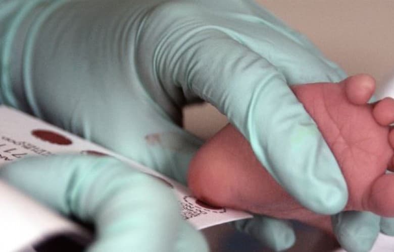 Nis për herë të parë skriningu neonatal në Spitalin e Mitrovicës