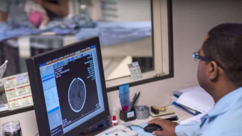 Shkencëtarët identifikojnë bakteret që nxisin sklerozën e shumëfishtë