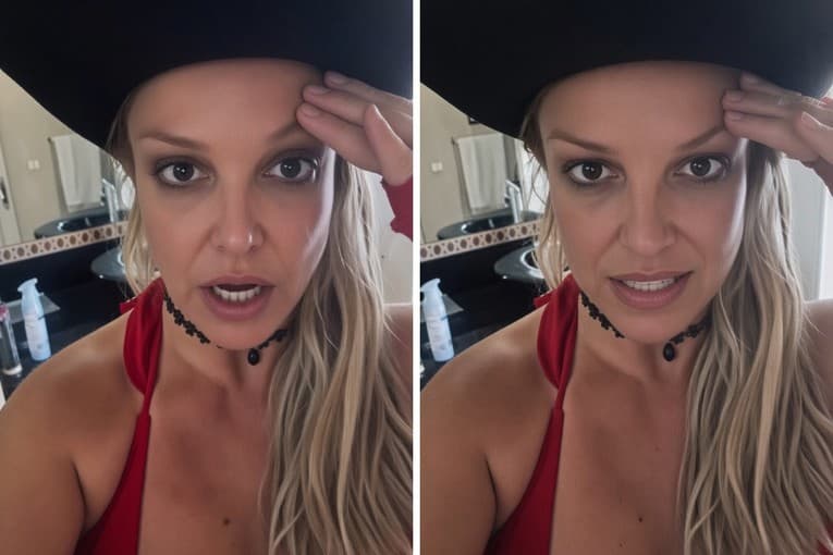 Britneyt i dështon botoxi, ngre alarmin për ndjekësit