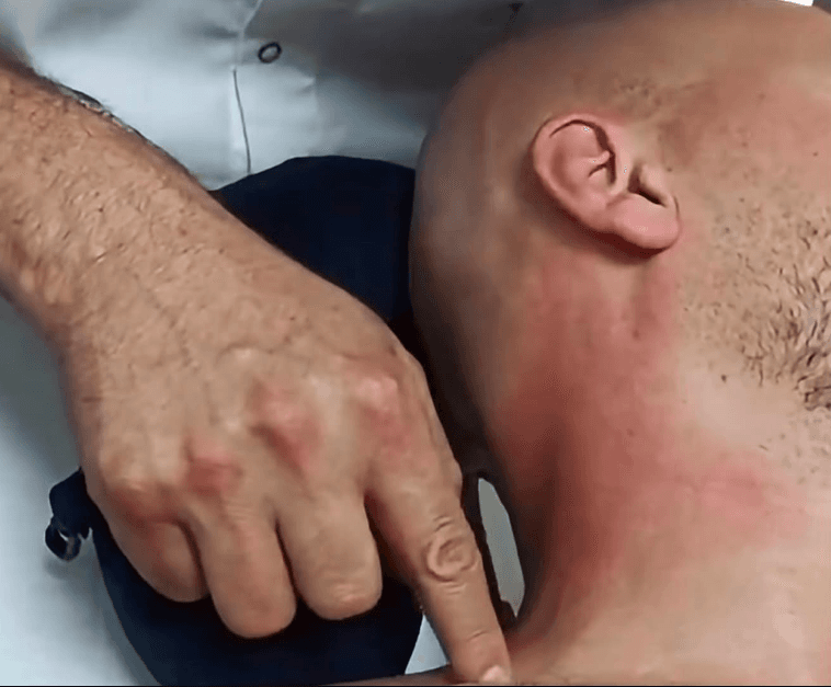 Marramendja mund të shkaktohet nga bllokimi i një muskuli, këshilla e fizioterapeutit