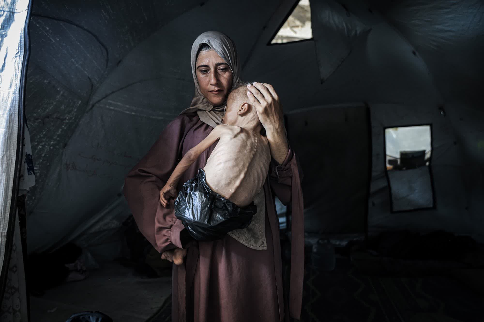 CNN: Uria në Gaza përmes fotografive