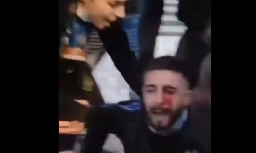E rëndë: Policia godet protestuesin me plumb gome në sy (VIDEO)