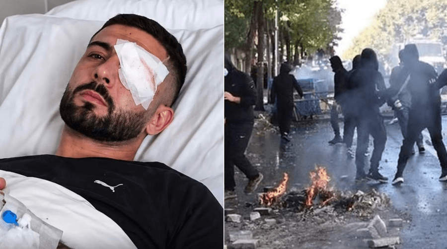 U plagos në sy gjatë protestës, Prokuroria nis hetim për rastin e Erion Vishkullit